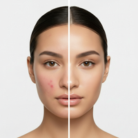 Promotes Clearer-Looking Skin